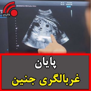 شوک وزارت بهداشت به مادران باردار