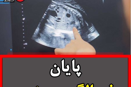 شوک وزارت بهداشت به مادران باردار